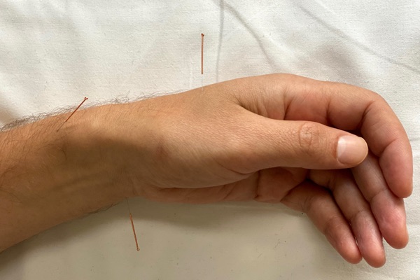 Yvonne Tsang Acupunctuur
